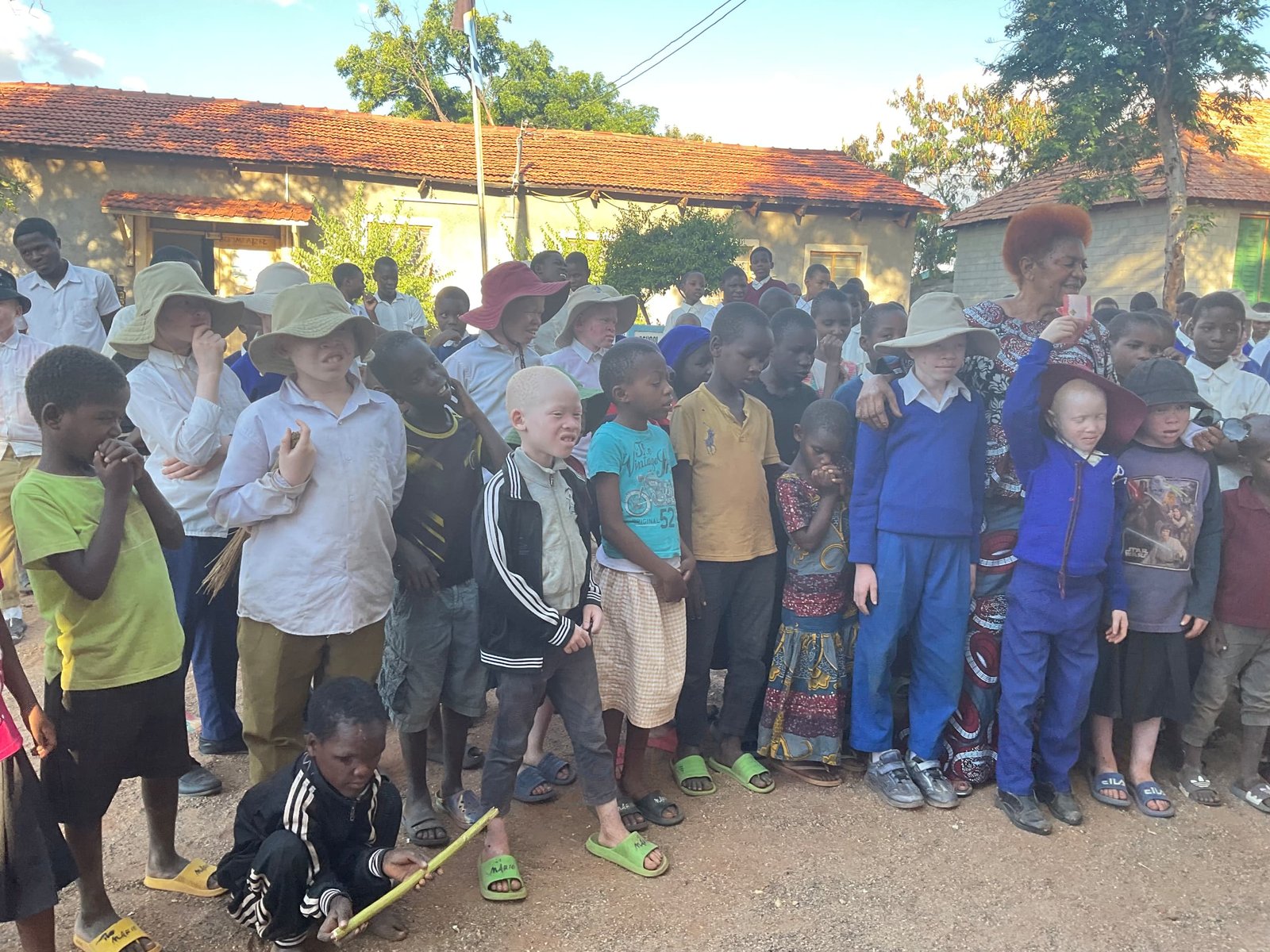 School outreach for children with albinism